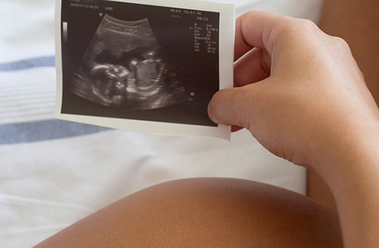 Pregnant woman holding an ultrasound photo
